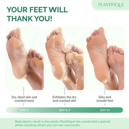 SeoulSkin Glycolic Acid Foot Peeling Mask (1 Pair), Korean Peeling & Exfoliating | Deep Exfoliation with Glycolic Acid, Removes Dead Skin, Cruelty-Free, Foot Peel Off Mask